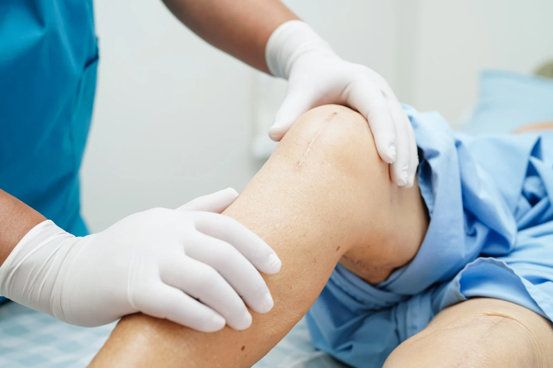 Affordable Knee Surgery – Everything You Need to Know