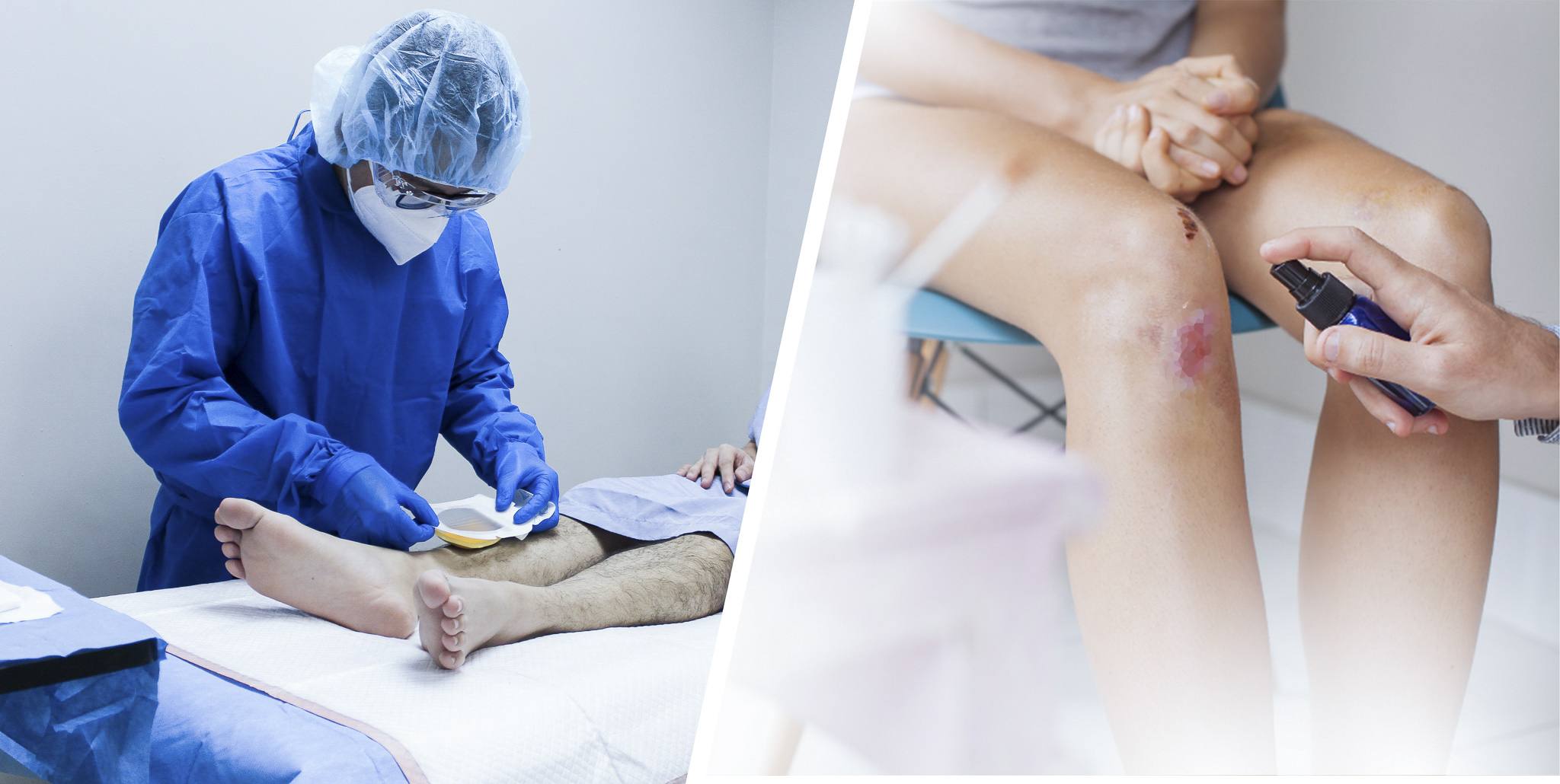 Everything You Need to Know About Seeing a Wound Care Specialist Philippines